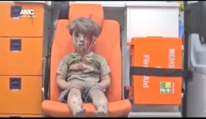 a-syrian-boy-after-an-airstrike-at-aleppo-white-hair-from-dust
